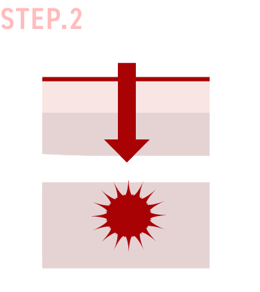 STEP2